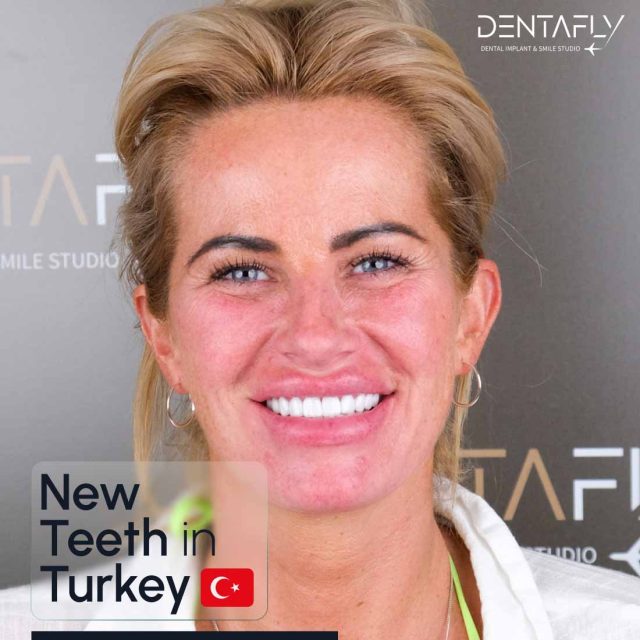 teeth in Turkey