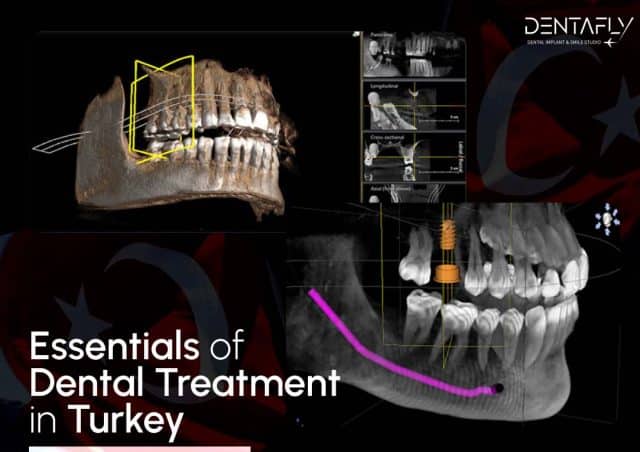 Essentials of dental treatments