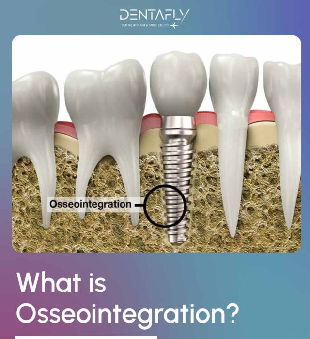 Osseointegration healing process