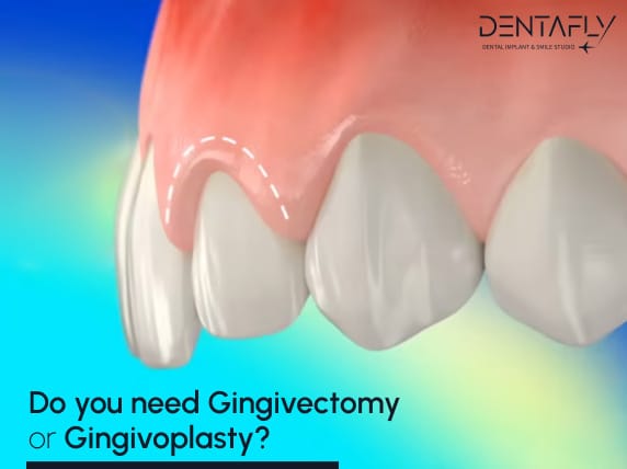 gingivectomy treatment decision