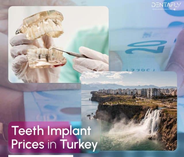 teeth implant prices in Turkey