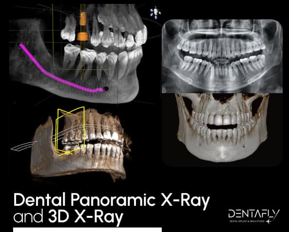 3d X-ray dental panoramic
