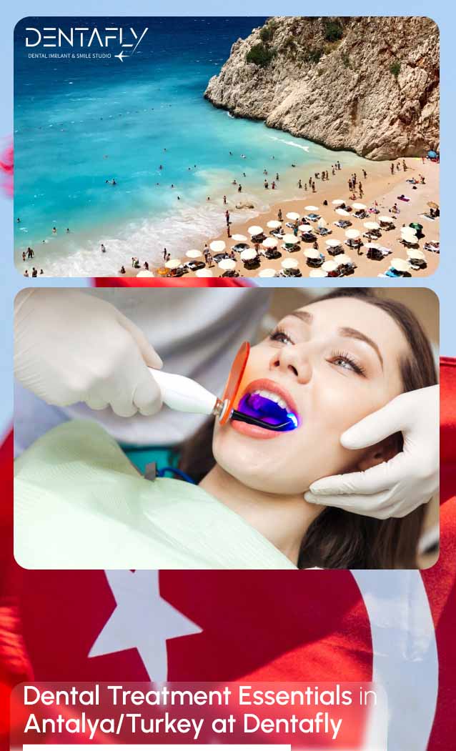Dental treatments in Turkey essentials