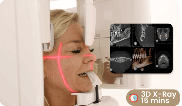 Antalya Implant Treatment Prices 2024 | In One Day