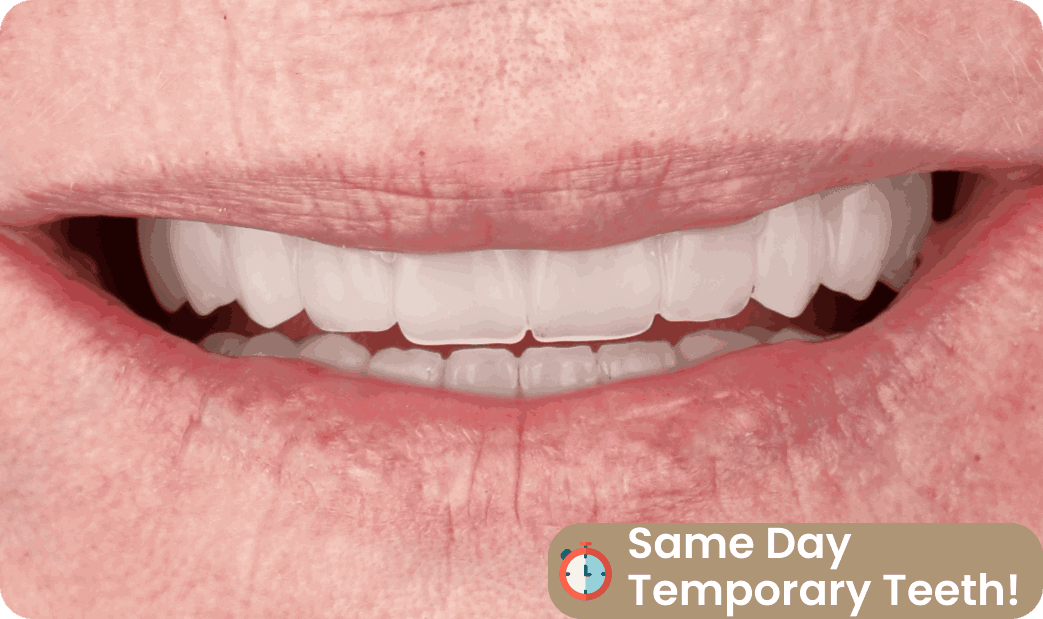 temporary teeth