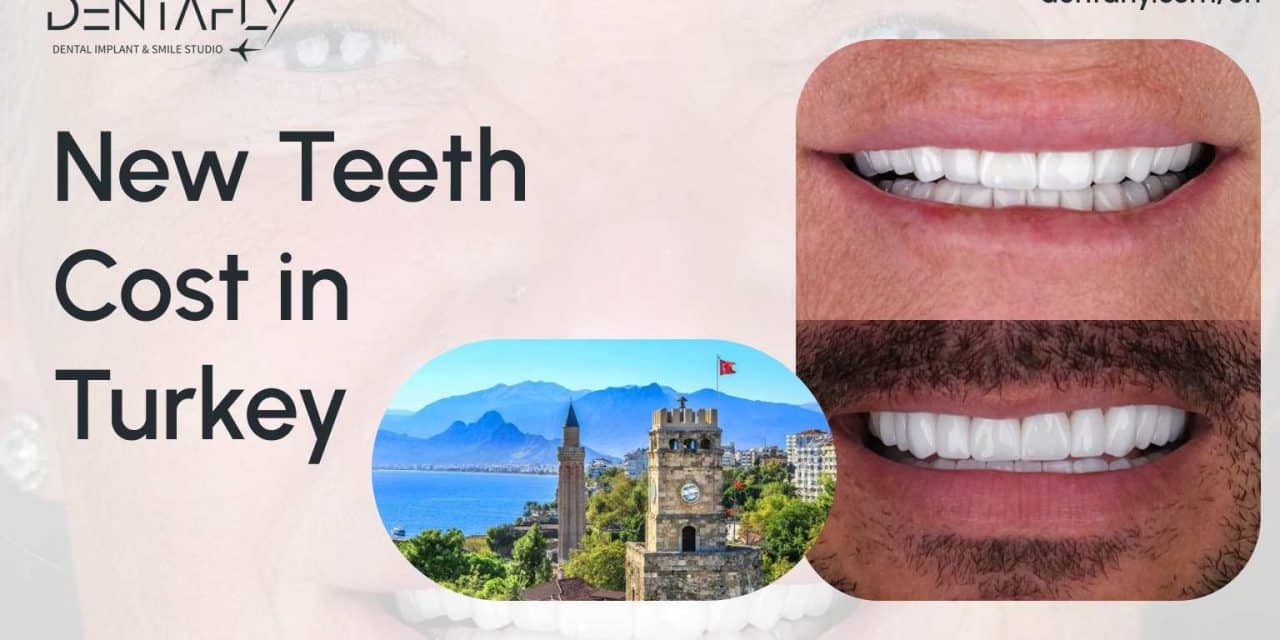New Teeth in Turkey: Costs, Packages, Procedure 2023