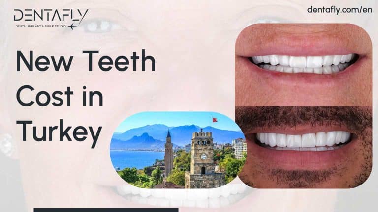 New Teeth Reviews in Turkey - Denta Fly