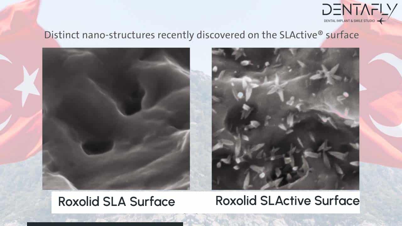 roxolid surface Detailed view
