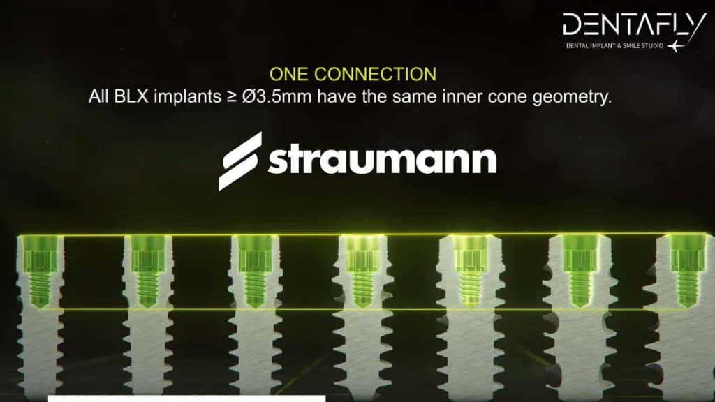 Strammon Straumann Implant Prices in Turkey: Cost & Features 2026