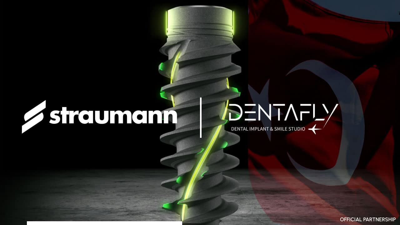 Straumann Dental Implants in Dentafly