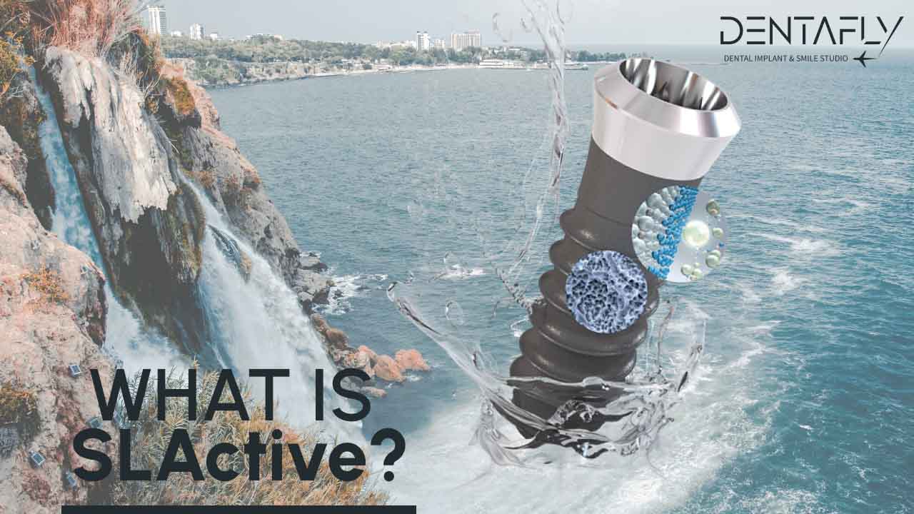 What is SL Active?