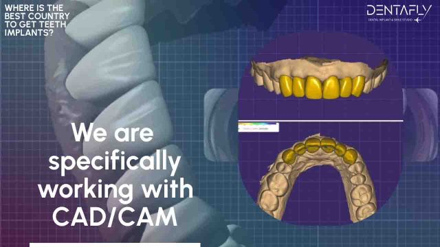 cad/cam dental implants in Turkey