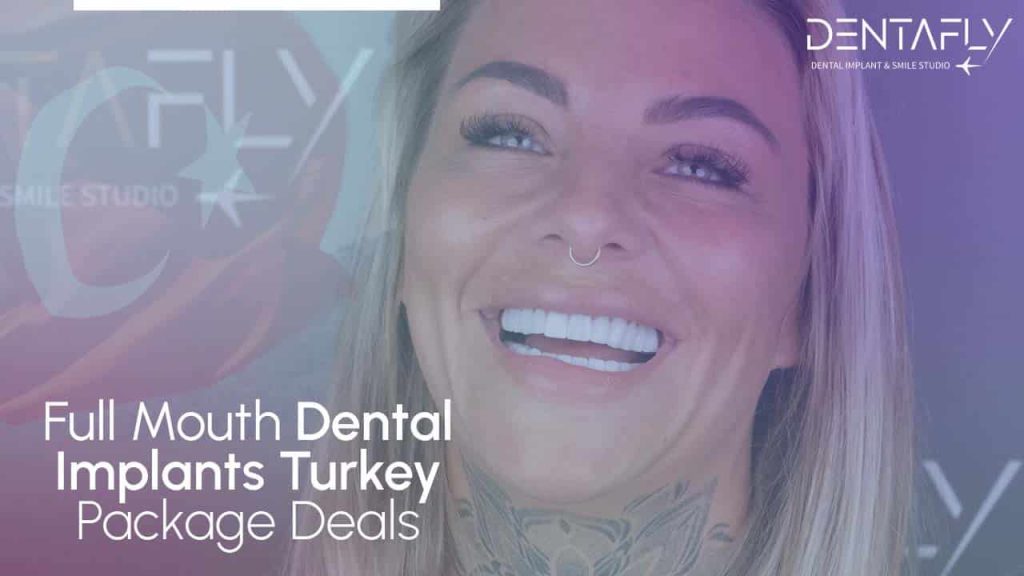 Full Mouth Dental Implants in Turkey: Full Guide for Everyone
