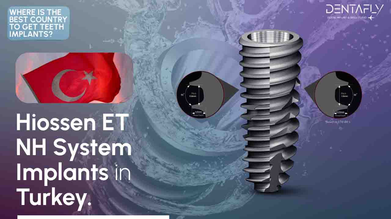Hiossen Et dental implants