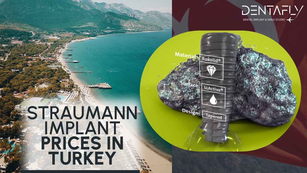 strauman implant prices in Turkey