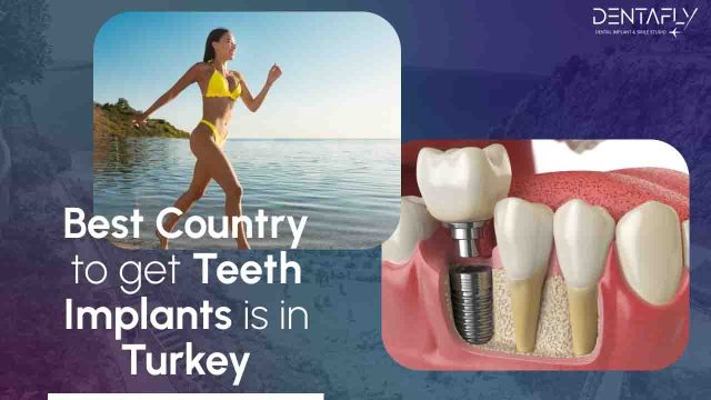 teeth implants in Turkey