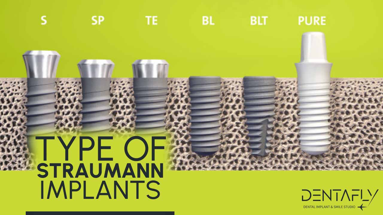 type of Straumann dental implants