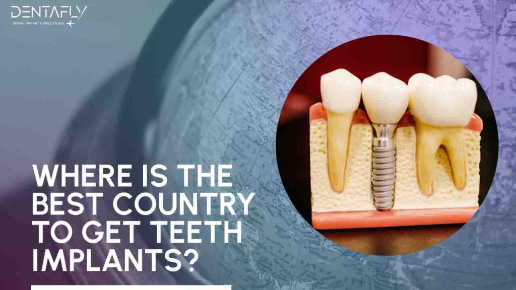 Where is the best country to get teeth implants?