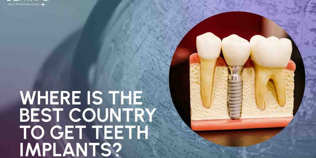 https://dentafly.com/wp-content/uploads/2022/11/where-is-the-best-country-to-get-teeth-implant-1280x640.jpg