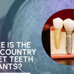 Where is the best country to get teeth implants?