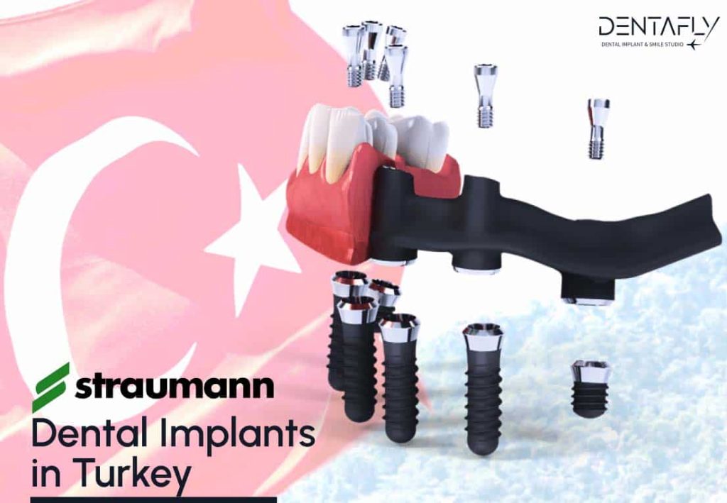 Best Dental Implant Prices in Turkey – 2023 Packages