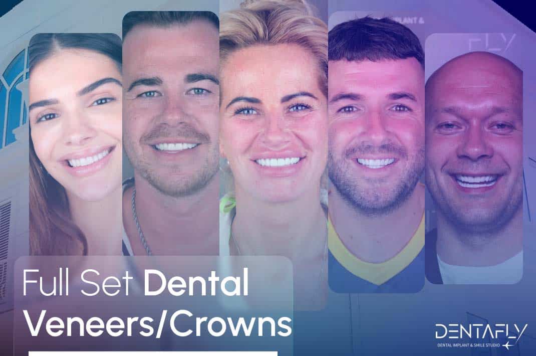 fullset dental veneers in Turkey