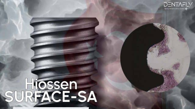 Hiossen Surface SA
