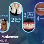 Smile makeover in Turkey: All Steps