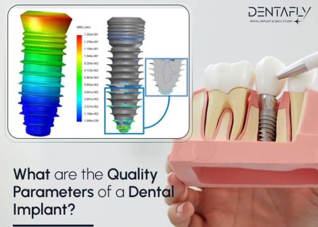 what are the quality parameters of dental implants