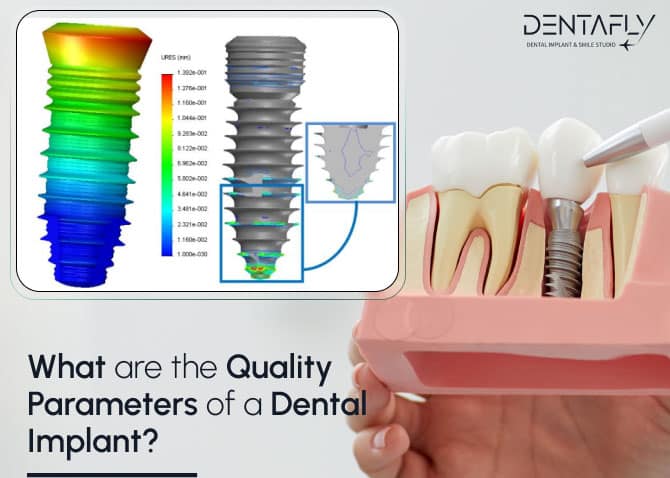 what are the quality parameters of dental implants