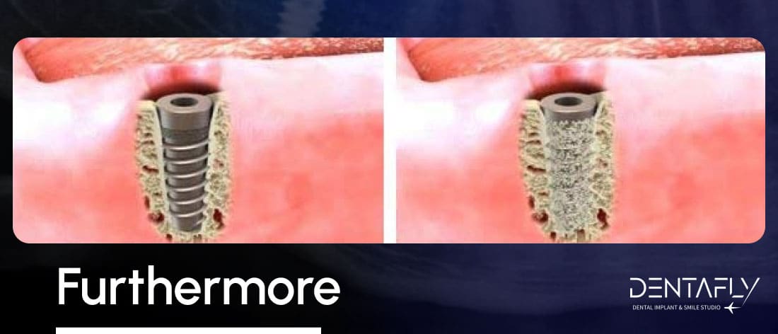 after osseointegration treatment