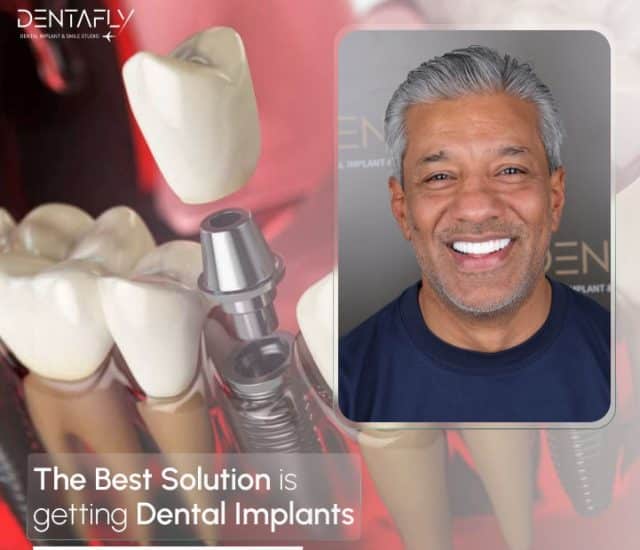 best solution is dental implant treatment