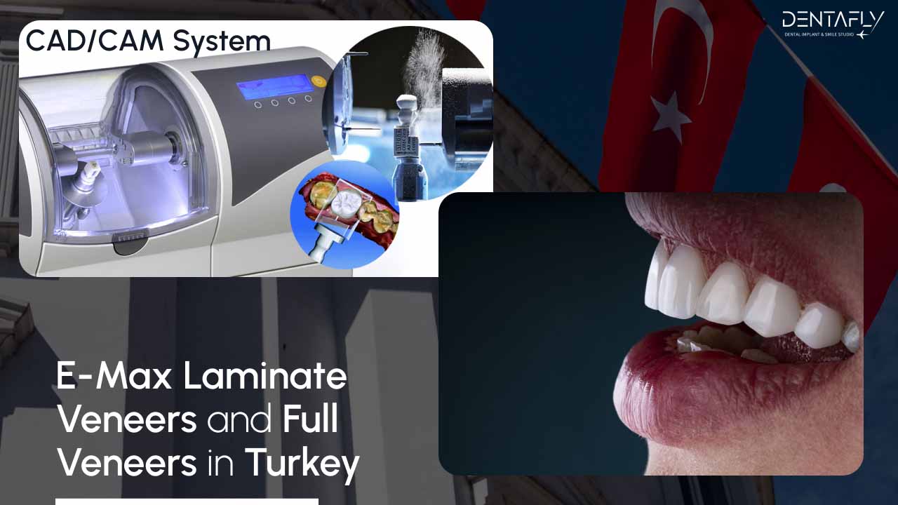 cad cam systems in digital dentistry