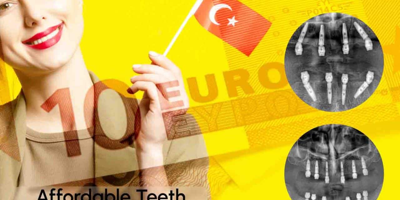 Teeth Implants: All About Costs in Turkey