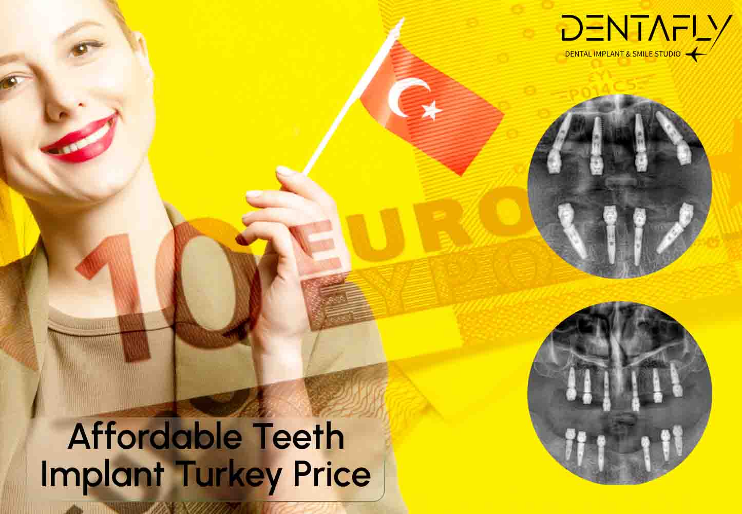 Teeth Implants All About Costs in Turkey Denta Fly