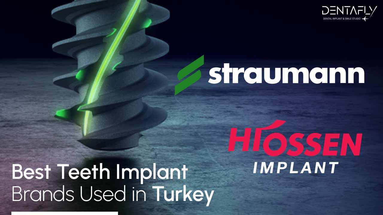 Best teeth implant brands
