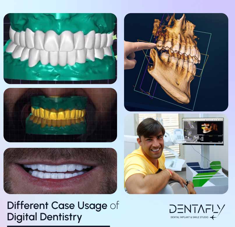 Different case usage of digital dentistry