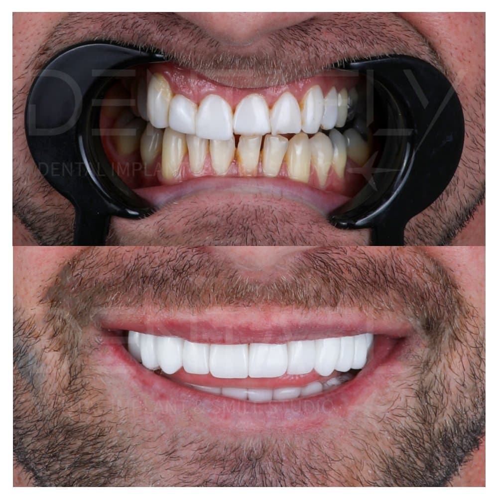 smile-design-before-after-10