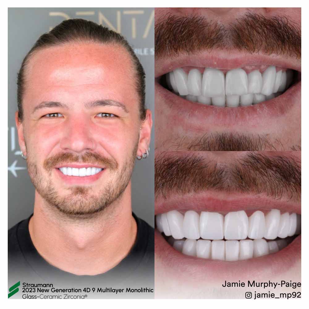 Jamie Murphy Paige - Before After
