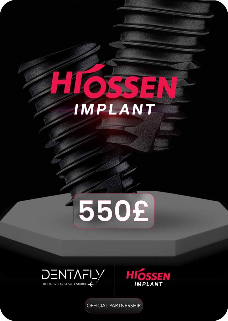 Cost of Dental Implants: Payment Plans, Pricing Table | £550