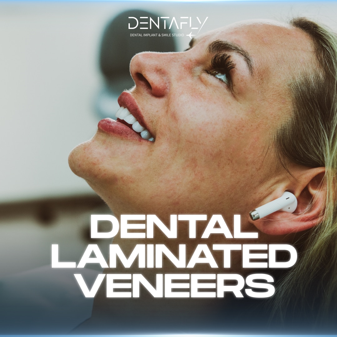 dental-veneers-1080x1080-3