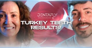 Turkey Teeth Results at Dentafly