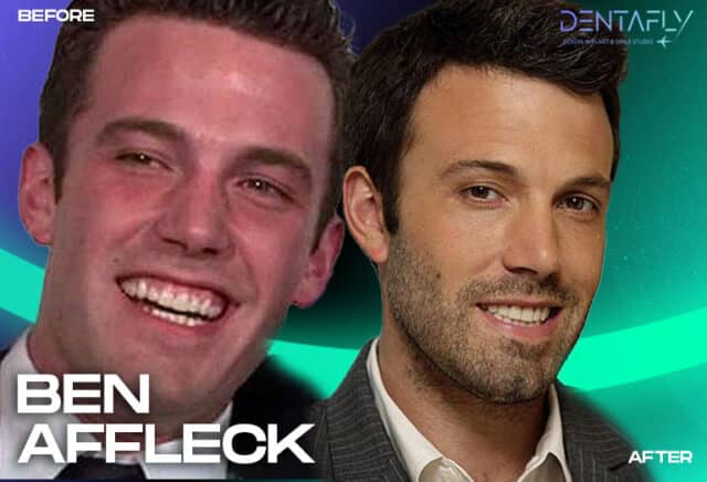 Ben Affleck Before and After