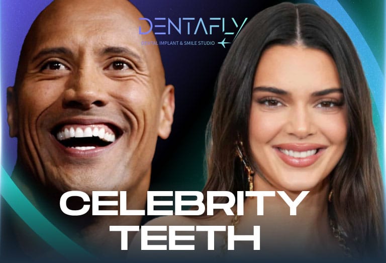 Celebrity Teeth