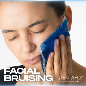 Facial Bruising