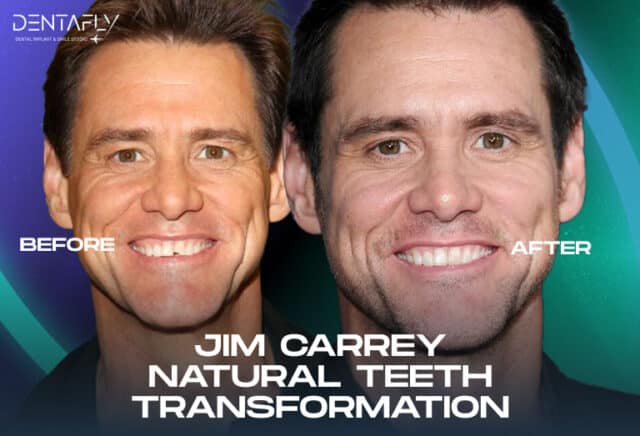 Jim Carrey's Natural Teeth Transformation