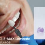 dentalcare of eMax dental veneers