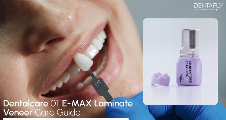 Dentalcare of Veneers Turkey – Aftercare e.Max Veneers