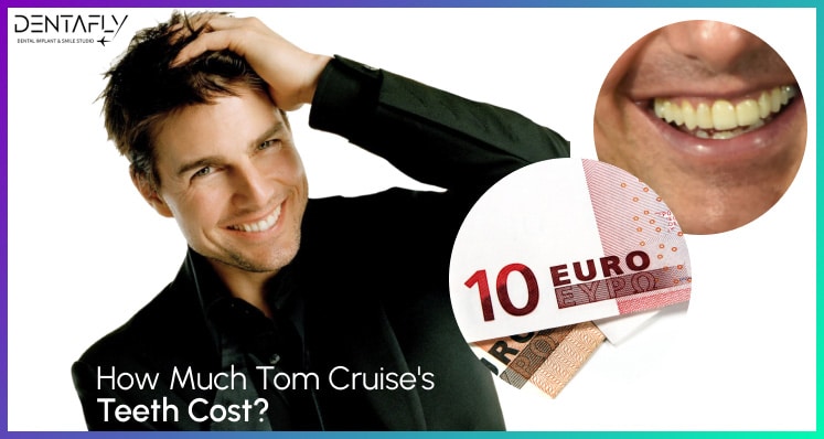 How much Tom Cruise's Teeth cost?