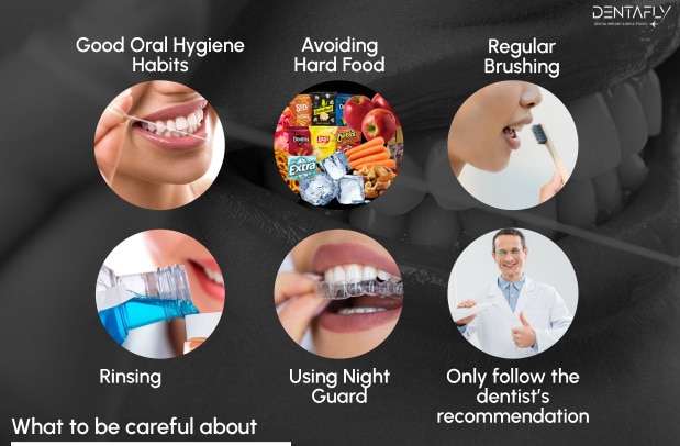 What to be do for dental veneer hygiene